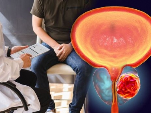 Câncer de mama masculino: informação para reduzir a mortalidade!