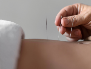 Acupuntura em oncologia: como funciona e quais os benefícios para os pacientes